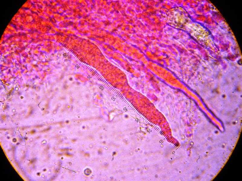 Crosta da determinare (Peniophora incarnata)